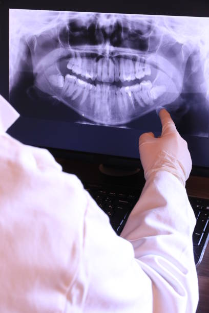 Best Emergency Gum Treatment in Stockton, MO